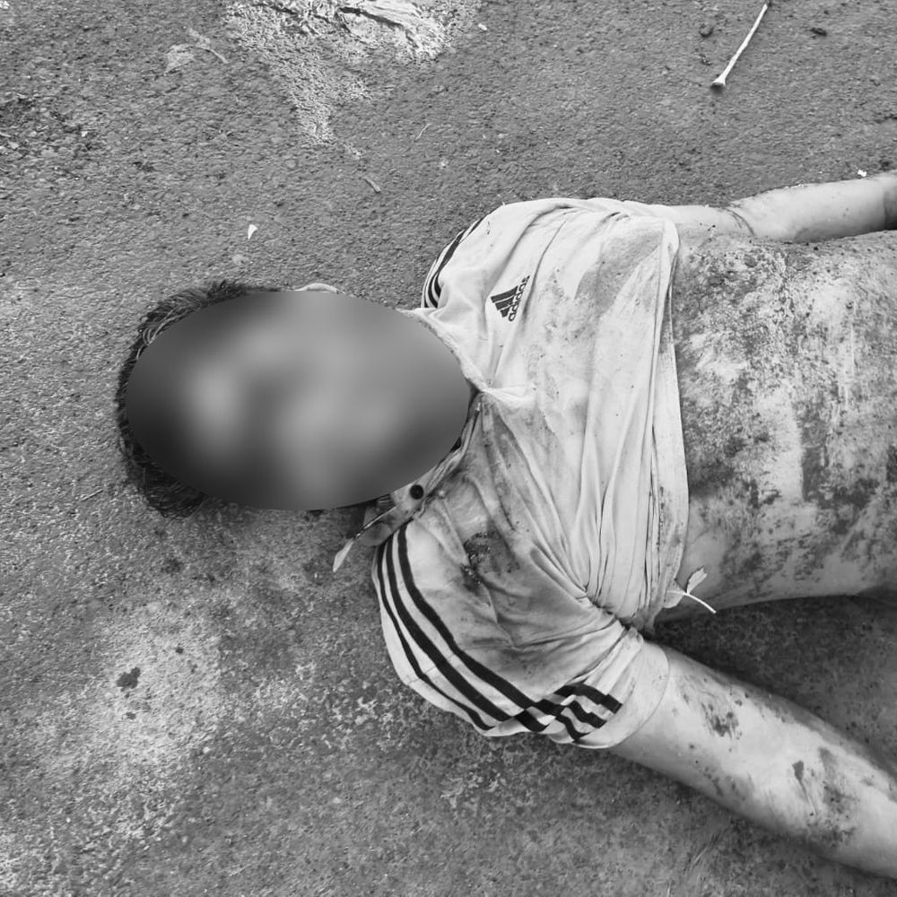 सोहना में एक्सीडेंट में वकील के बेटे की मौत:मॉर्निंग वॉक कर रहा, तेज रफ्तार गाड़ी ने मारी टक्कर, कोर्ट में नो वर्किंग डे
