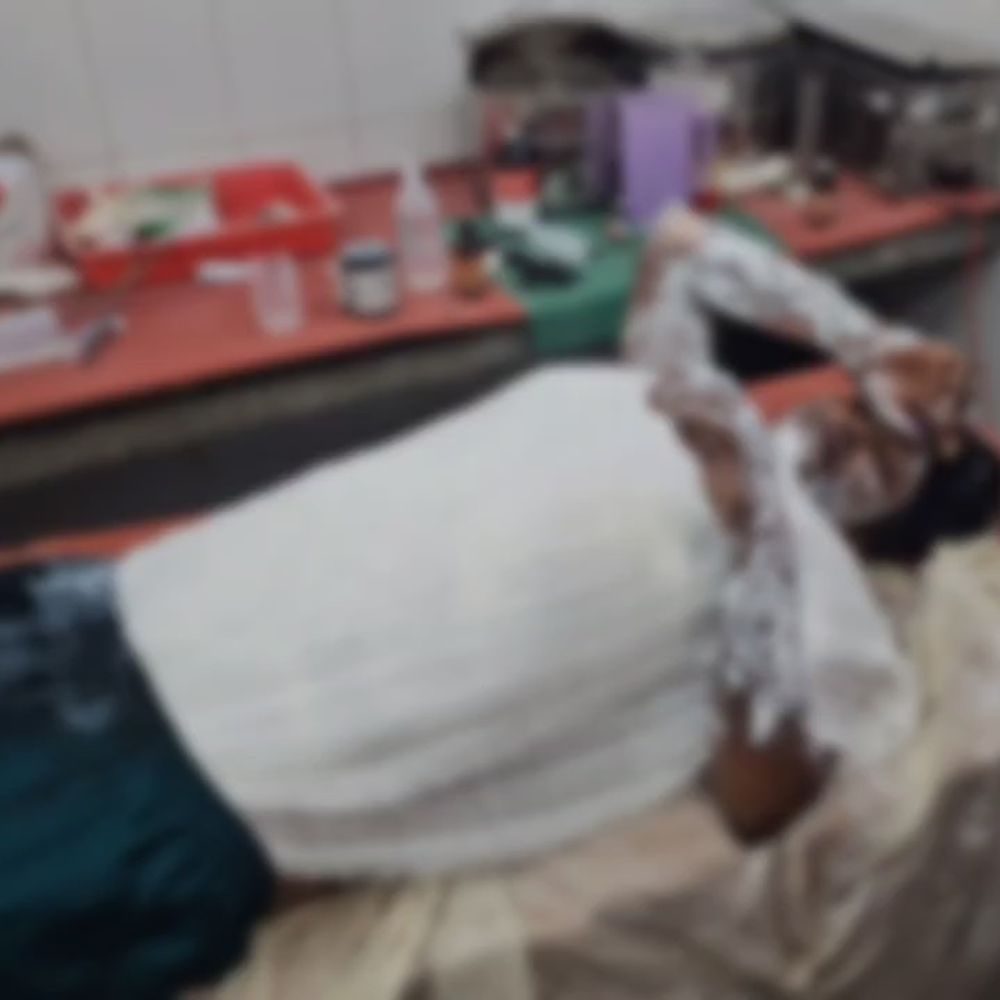 महिला दूध गर्म करते समय झुलसी:कपड़ों में आग लगने से गंभीर, हायर सेंटर रेफर