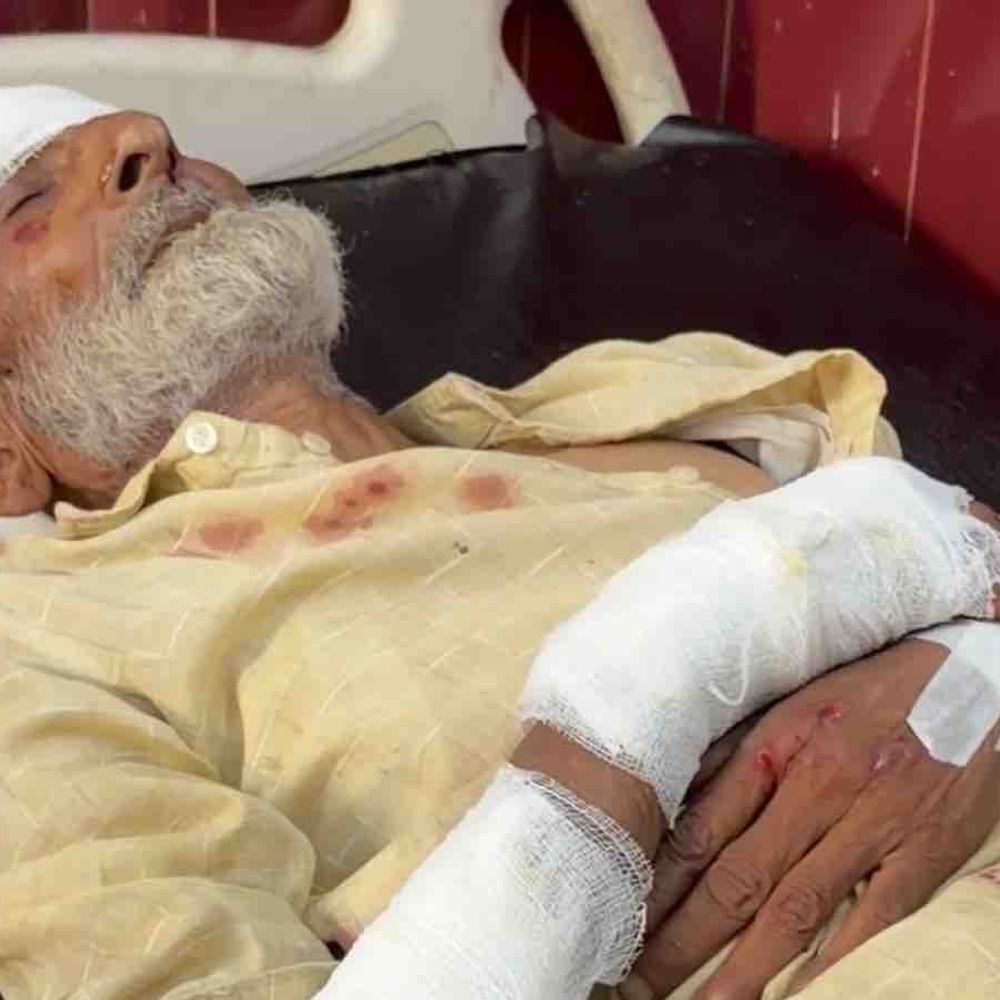 रामपुर में बुजुर्ग को वाहन ने मारी टक्कर:स्कूटी समेत सड़क पर गिरे, सिर-पैर में गंभीर चोट; जिला अस्पताल में भर्ती