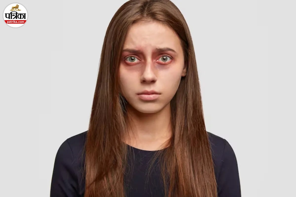 Dark Circles: आंखों के नीचे दिखने लगे हैं काले घेरे? डेली रूटीन में इन आसान टिप्स को करें शामिल