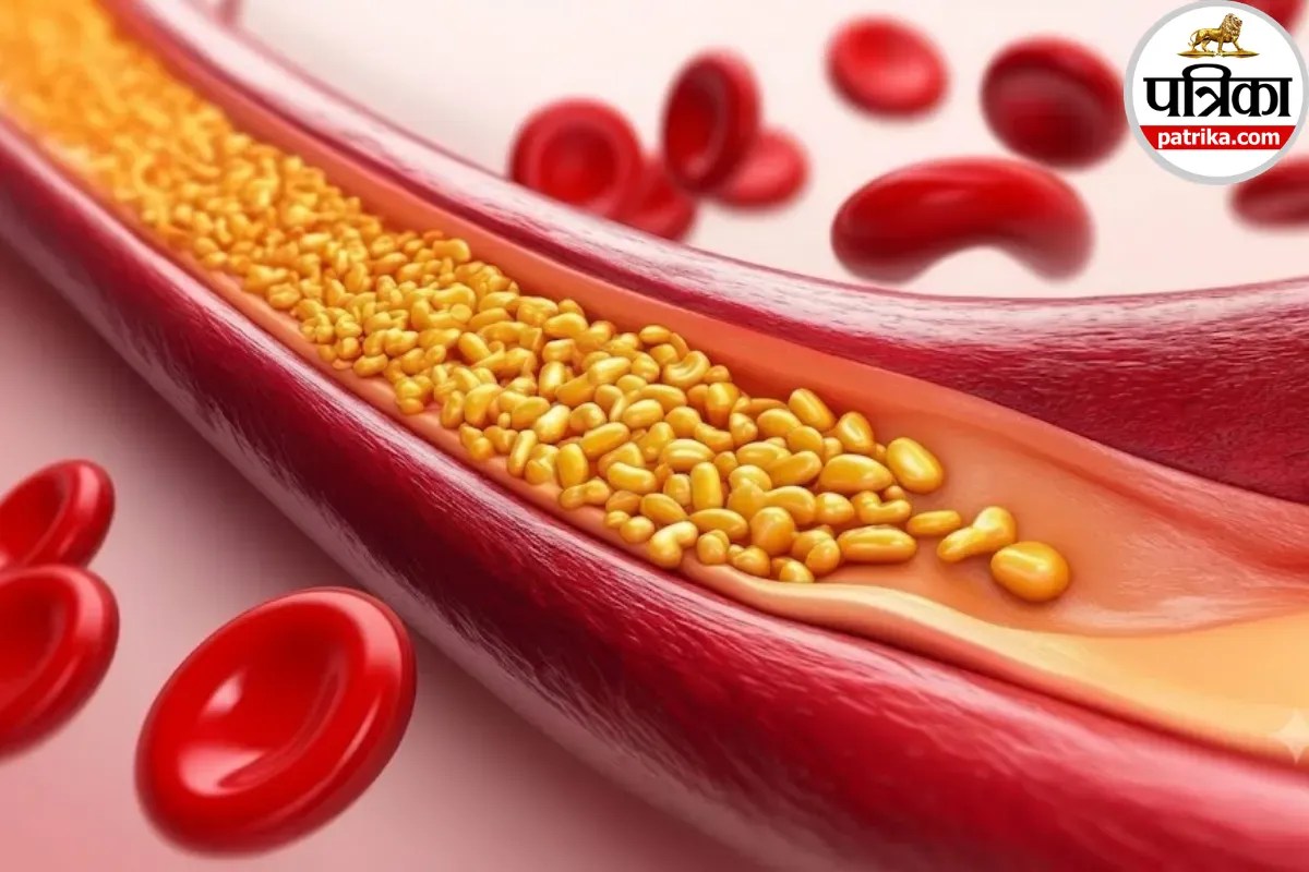 HDL Cholesterol: HDL कोलेस्ट्रॉल क्या है? मेयो क्लिनिक से जानिए अच्छे कोलेस्ट्रॉल का हार्ट हेल्थ से कनेक्शन