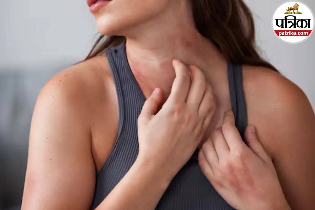 बार-बार होने वाले दर्दनाक फोड़ों को न समझें मामूली, Hidradenitis Suppurativa हो सकती है वजह, मेयो क्लिनिक से जानें इसके संकेत