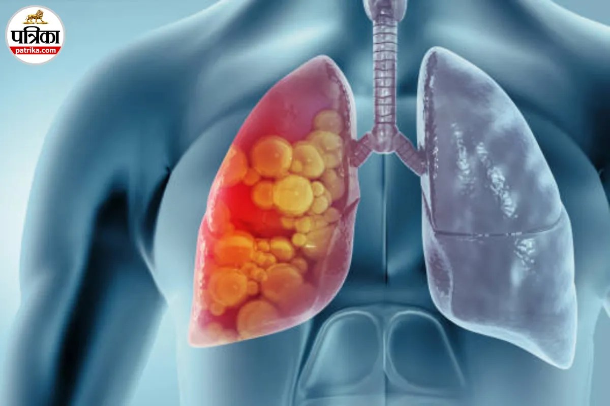 सिगरेट छोड़ दी, फिर भी इन चीजों से रहता है Lung Cancer का खतरा
