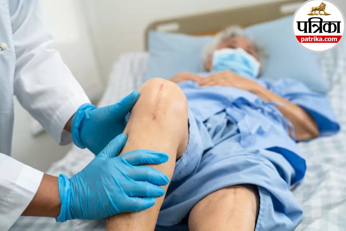 घुटनों के दर्द से हर कदम हो रहा है भारी, जानिए कब पड़ती है Partial Knee Replacement की जरूरत