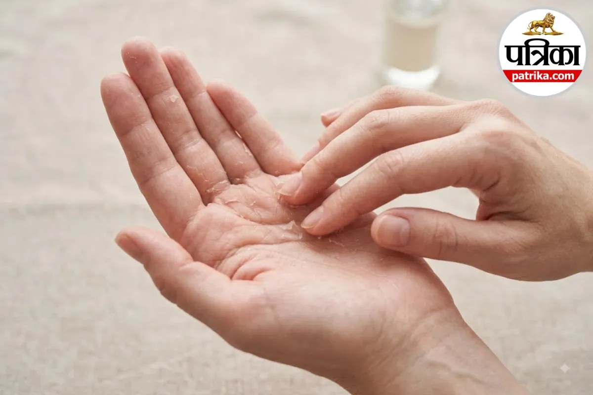 Skin Peeling: हाथों की त्वचा क्यों उतरती है? Healthline और Mayo Clinic ने बताए इसके कारण और बचाव के उपाय
