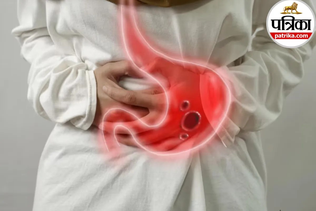 Stomach Ulcer: पेट में बार-बार जलन और दर्द को न करें नजरअंदाज, एनएचएस ने बताया पेट का अल्सर हो सकता है वजह