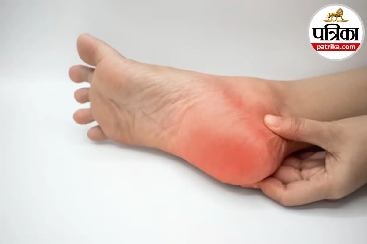 चलते ही एड़ी में दर्द क्यों होता है? क्लीवलैंड क्लिनिक से जानिए Heel Pain के कारण और संकेत