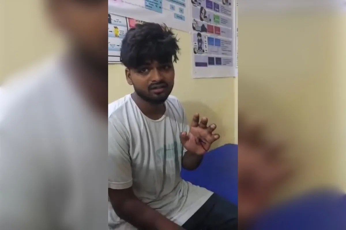 महज 800 रुपए के लिए चली गोली, चंदौली में युवक की हथेली छेदकर निकली, मोबाइल बनाने को लेकर था विवाद