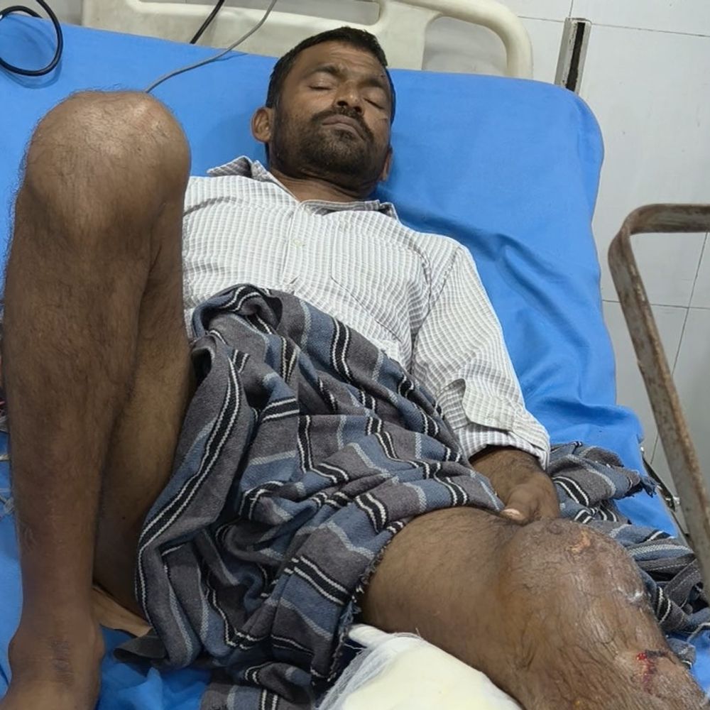 फिरोजाबाद निवासी ऑटो दुर्घटना में घायल:खड़े वाहन से टकराया ऑटो, चालक फरार, मामला दर्ज