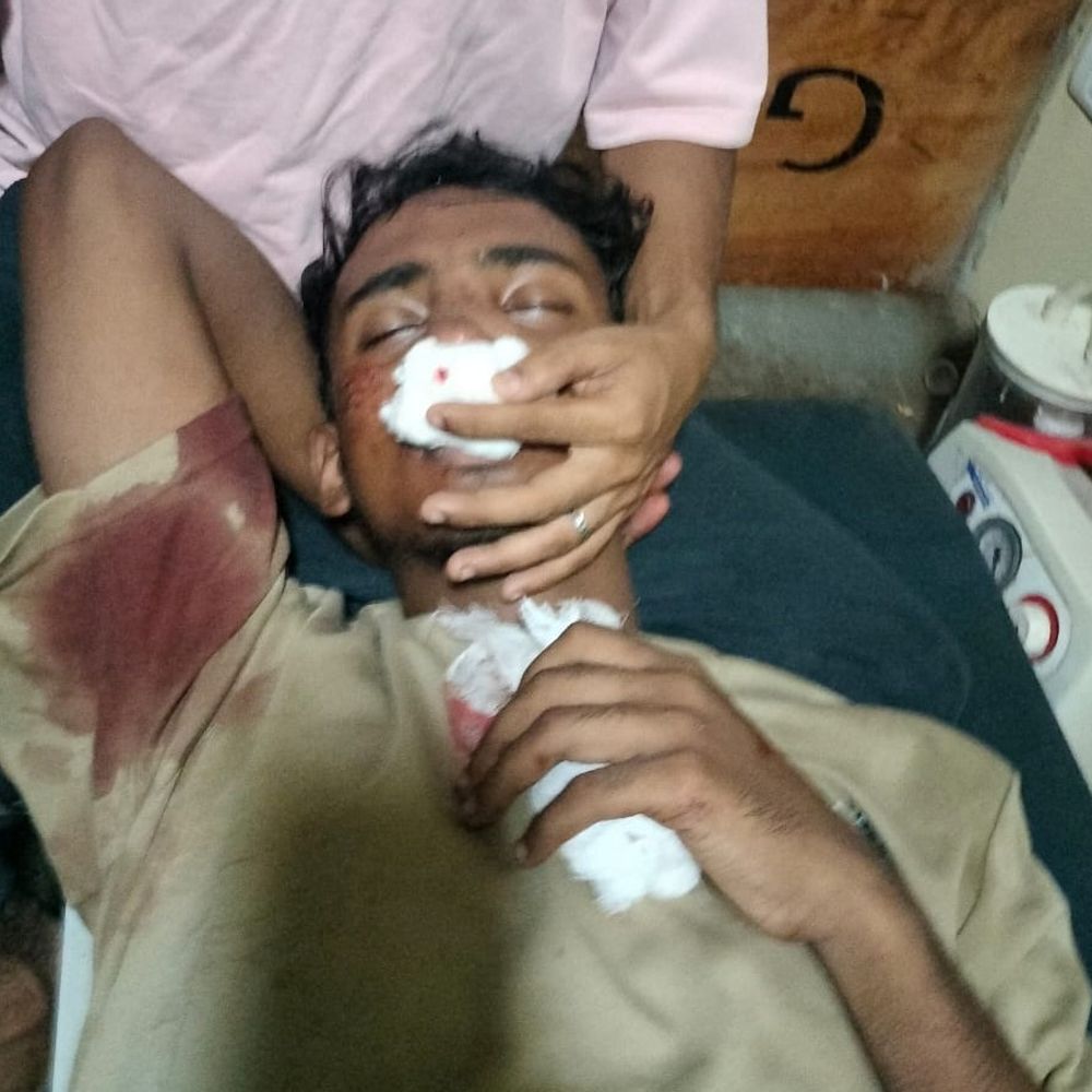 तारापुर में युवक से मारपीट, नाक की हड्डी टूटी:लोहे के पंच से हमले का आरोप; मायागंज रेफर, FIR दर्ज
