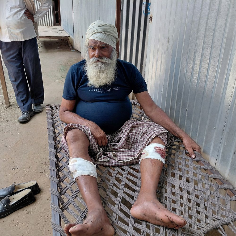 चोरी का विरोध करने पर सुरक्षाकर्मी को मारी गोली:खगड़िया में फोरलेन बेस कैंप पर हुई वारदात, पैर से आर-पार हुआ बुलेट