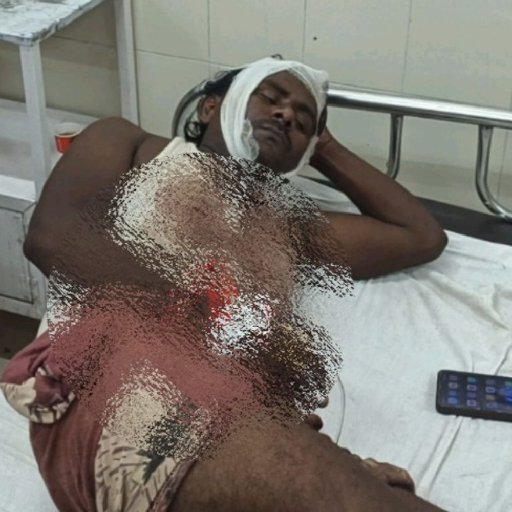 उन्नाव में शौच को गए युवक पर हमला:शराब पी रहे लोगों ने फावड़े-कुल्हाड़ी से पीटा, अस्पताल में भर्ती
