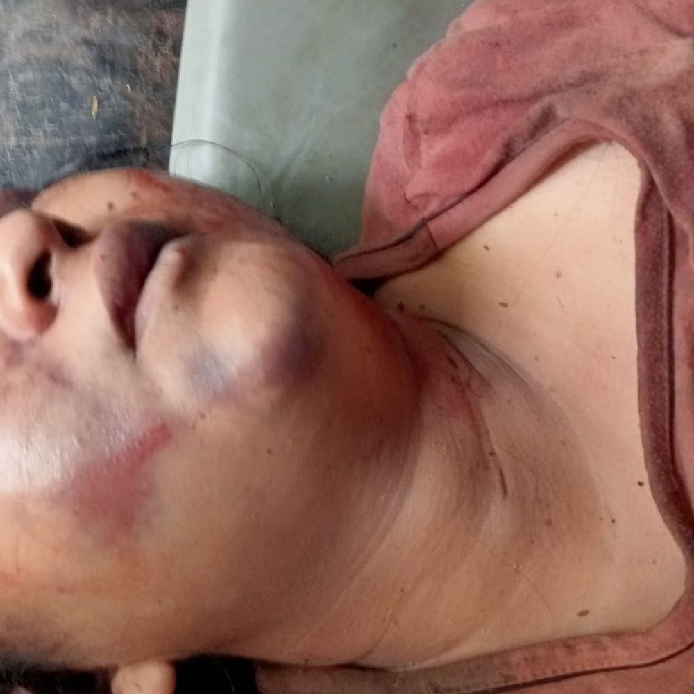 होशियारपुर में फौजी पर पत्नी की हत्या का आरोप:मृतका के परिजन बोले- मारपीट से हुई मौत, छत से गिरने की बताई झूठी कहानी