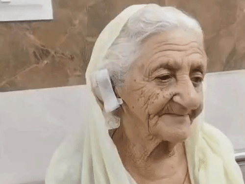 फतेहाबाद में बुजुर्ग महिला का बंदर ने कान काटा:छत पर सूख रहे कपड़े लेने गई थी बुजुर्ग; छह टांके लगाने पड़े