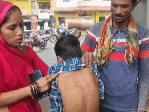 छतरपुर में 11 वर्षीय छात्र से स्कूल में मारपीट:पीठ पर चोट के निशान, परिजन बोले- टीचर ने मारा, फिर स्कूल से भगा दिया