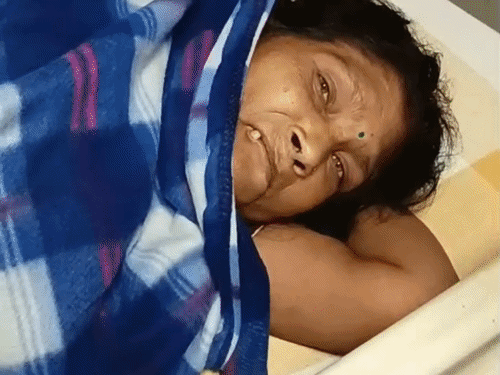 समस्तीपुर- 36 वायल एंटी-स्नेक वेनम देकर बुजुर्ग की बचाई जान:आलू निकालने गई तो कोबरा ने डंसा; डॉक्टरों ने रेफर किया, कर्मियों ने सीपीआर, ऑक्सीजन सपोर्ट देकर किया इलाज