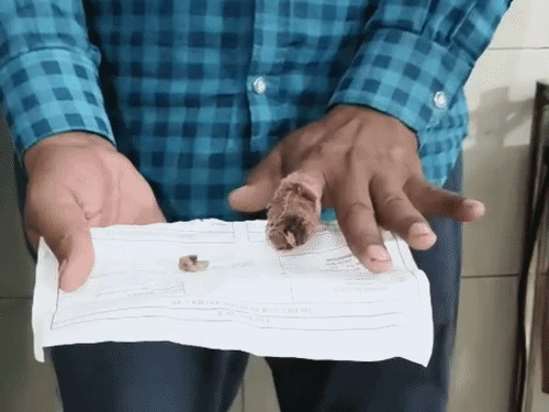 बिजली बिल जमा करने को कहा, तो उंगली काटी:समस्तीपुर में बड़े भाई पर छोटे का हमला; मां को बचाने पहुंचा था घायल, हायर सेंटर रेफर