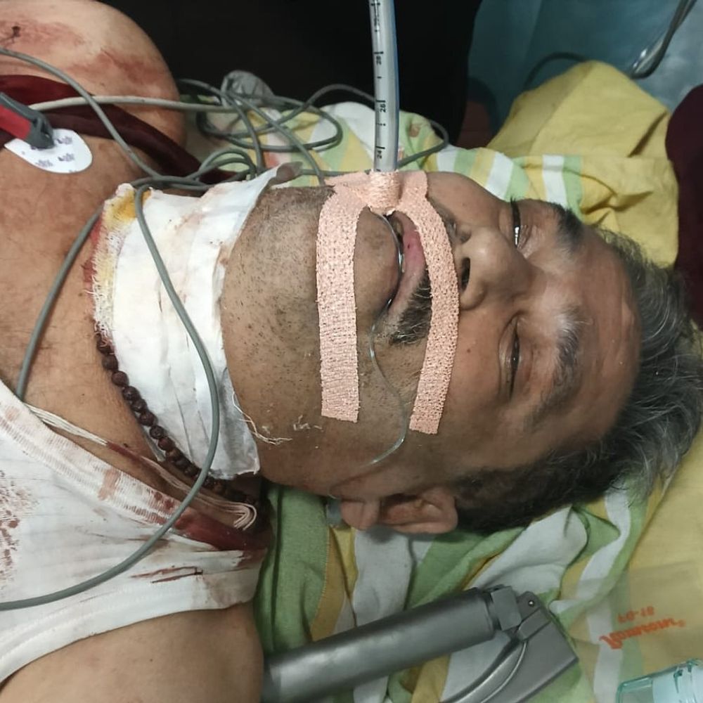 धनबाद में कोयला कारोबारी को लगी गोली:गले के निचले हिस्से में फंसी गोली, एसएसपी बोले- प्रथम दृष्टया आत्महत्या के प्रयास का मामला