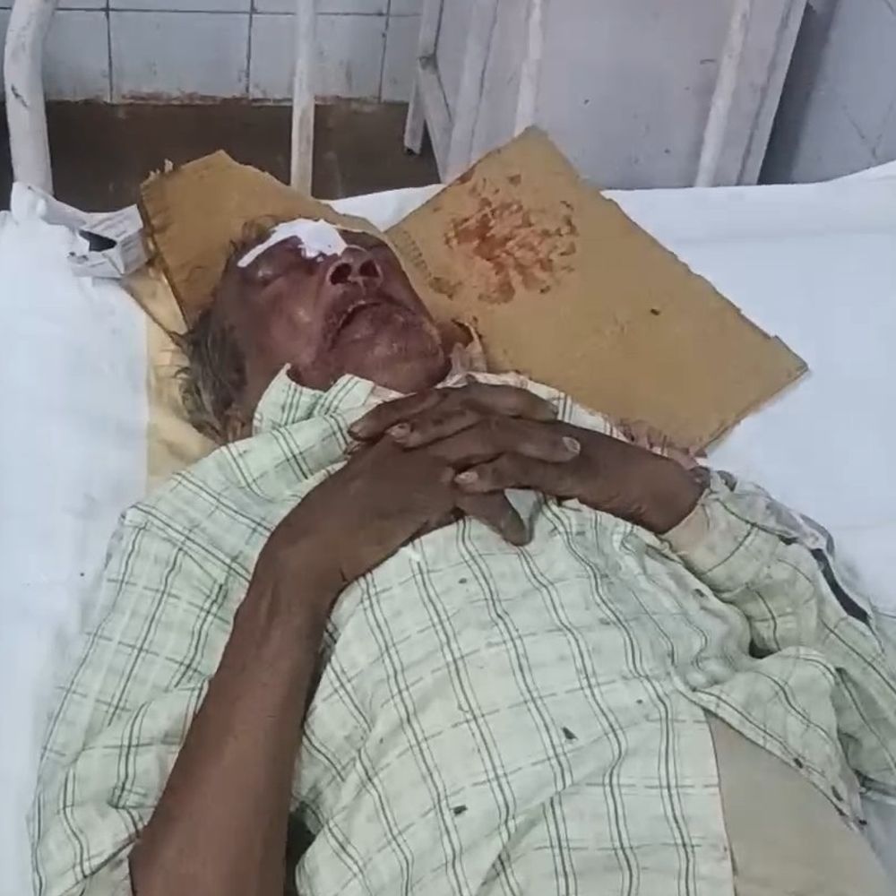 देवरी मोड़ पर स्कूटी-बाइक की भिड़ंत, दो घायल:ग्रामीणों ने अस्पताल पहुंचाया, प्राथमिक उपचार के बाद रीवा रेफर