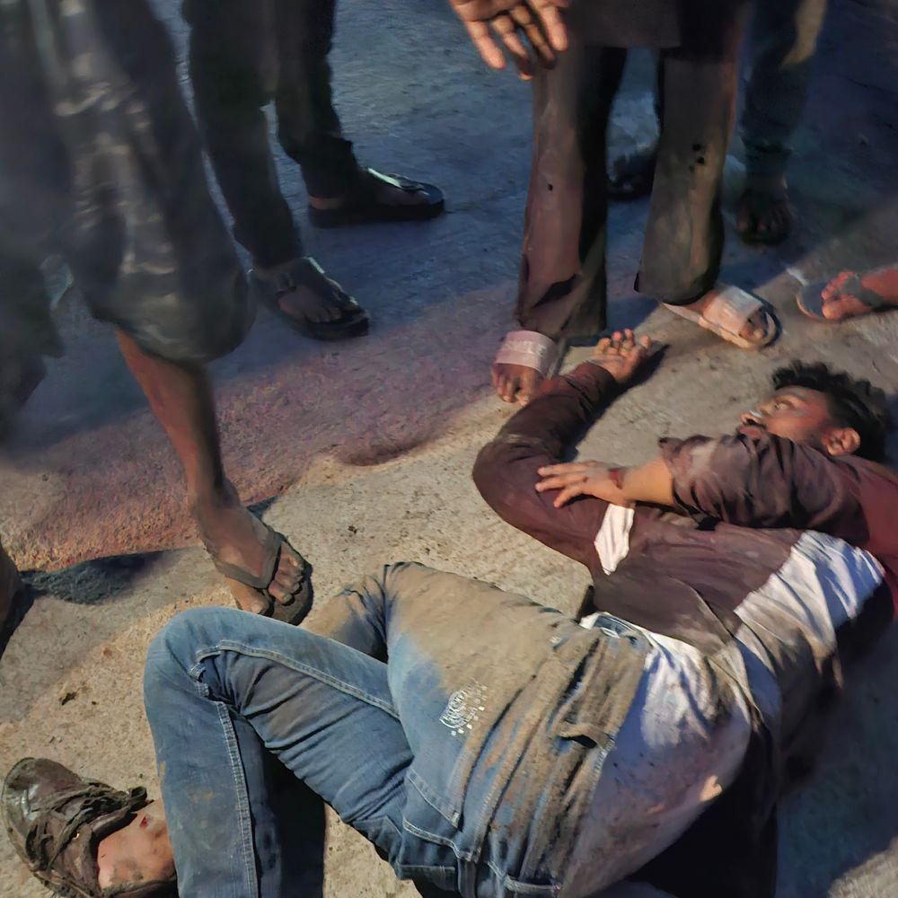 चंदौली में बाइक और चार पहिया वाहन की जोरदार टक्कर:युवक गंभीर, चालक वाहन समेत फरार; पुलिस ने घायल को अस्पताल पहुंचाया