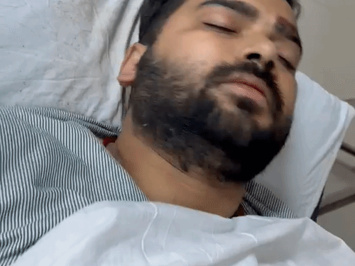 सिरगरेट लाने से मना करने पर पिस्टल की बट मारी:बीच-बचाव करने आए दोस्त पर हिस्ट्रीशीटर ने चढ़ायी स्कॉर्पियो, नौबस्ता में FIR