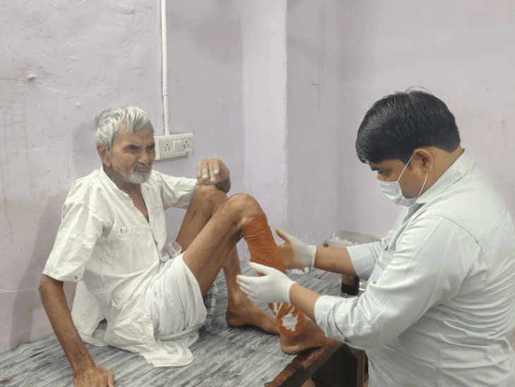 राजगढ़ में ‘मांस गलाने’ वाले संक्रमण की दस्तक:40 से ज्यादा मरीज, रोज 1-2 नए केस; एक का पंजा कटा, कई की चमड़ी-मांस निकालना पड़ा