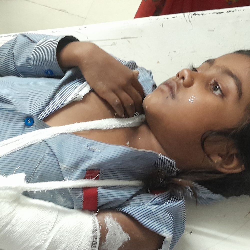 क्षमता से ज्यादा बच्चे वैन में भरने पर पलटी:भिंड में लोडिंग सामने आते ही बिगड़ा संतुलन; एक लड़की का हाथ फ्रैक्चर