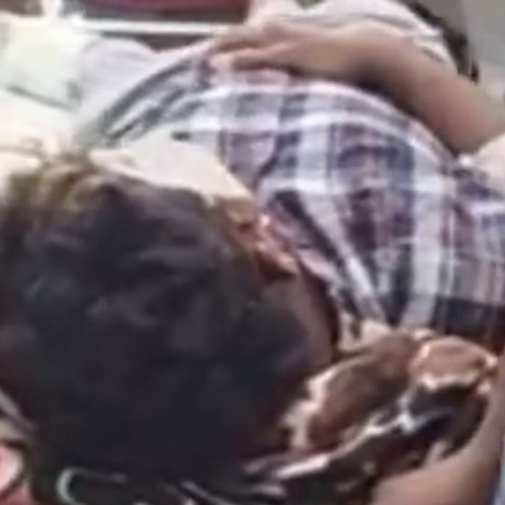 कैथल में बाइक राइडर ने मारी स्कूटी को टक्कर:युवक की टांग टूटी, बाजूओं और माथे पर गंभीर चोटें