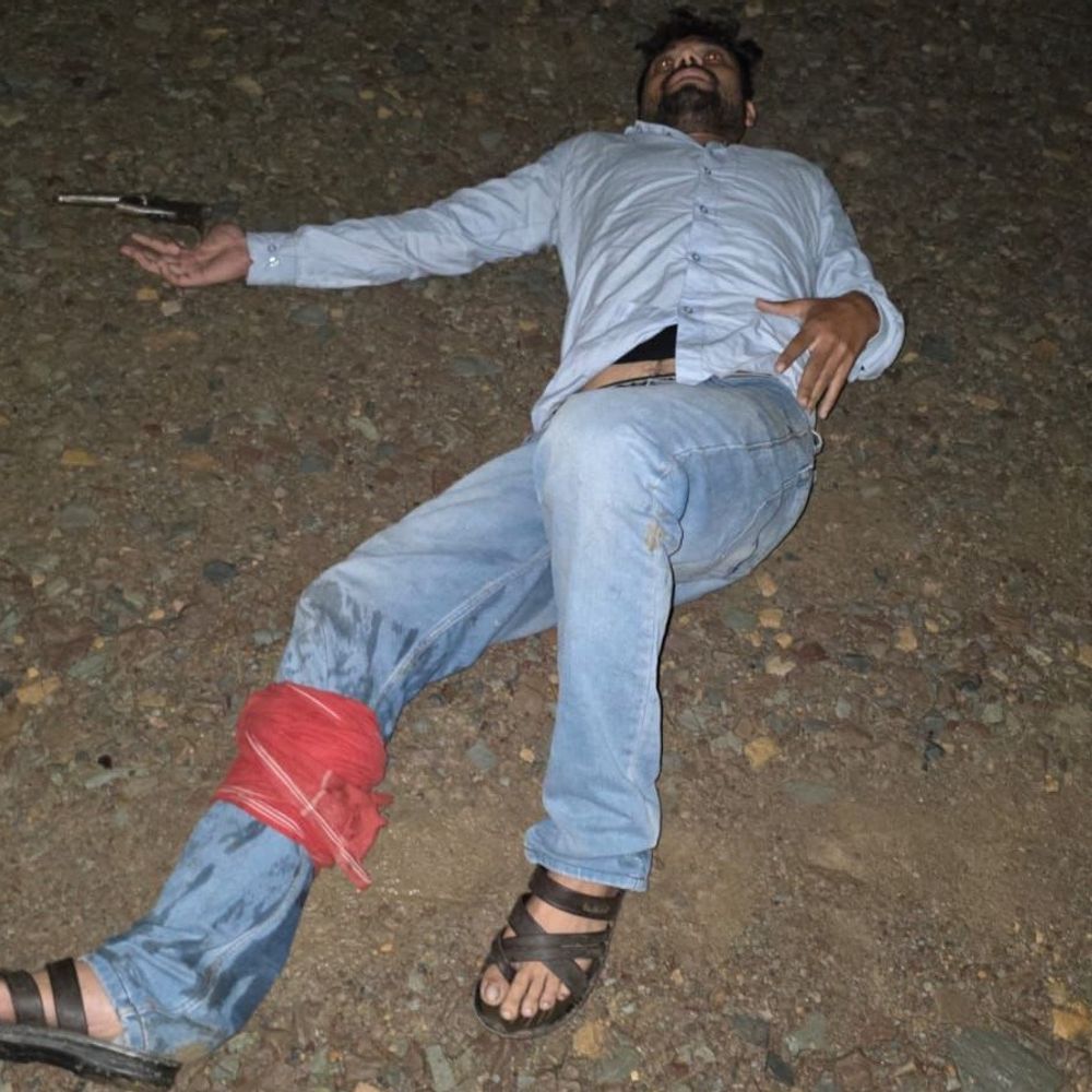 वाराणसी पुलिस ने चेन स्नेचर को मारी गोली:शिवपुर के खुशहाल नगर में छीनी थी चेन, मुठभेड़ में पैर में गोली लगने से लहूलुहान