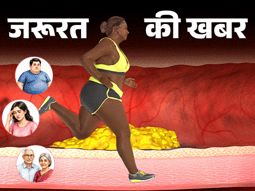 जरूरत की खबर- क्या कोलेस्ट्रॉल सचमुच हमारा दुश्मन है?:डॉक्टर से समझें गुड-बैड कोलेस्ट्रॉल का साइंस, ये कब जरूरी और कब खतरनाक