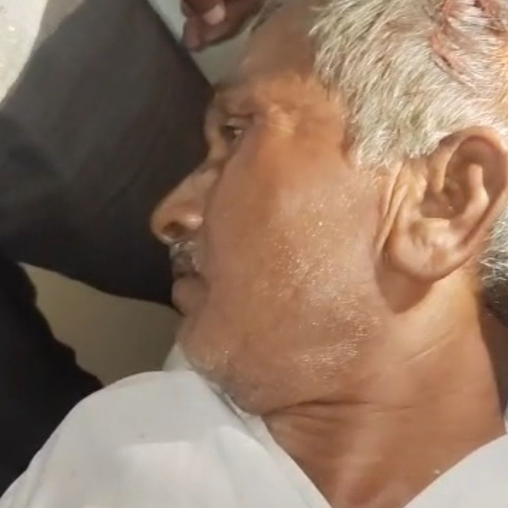 हरदोई में रंजिश में अधेड़ की जमकर पिटाई:शरीर पर गंभीर चोटें आईं, 20 हजार रुपए गायब; 5 पर केस दर्ज