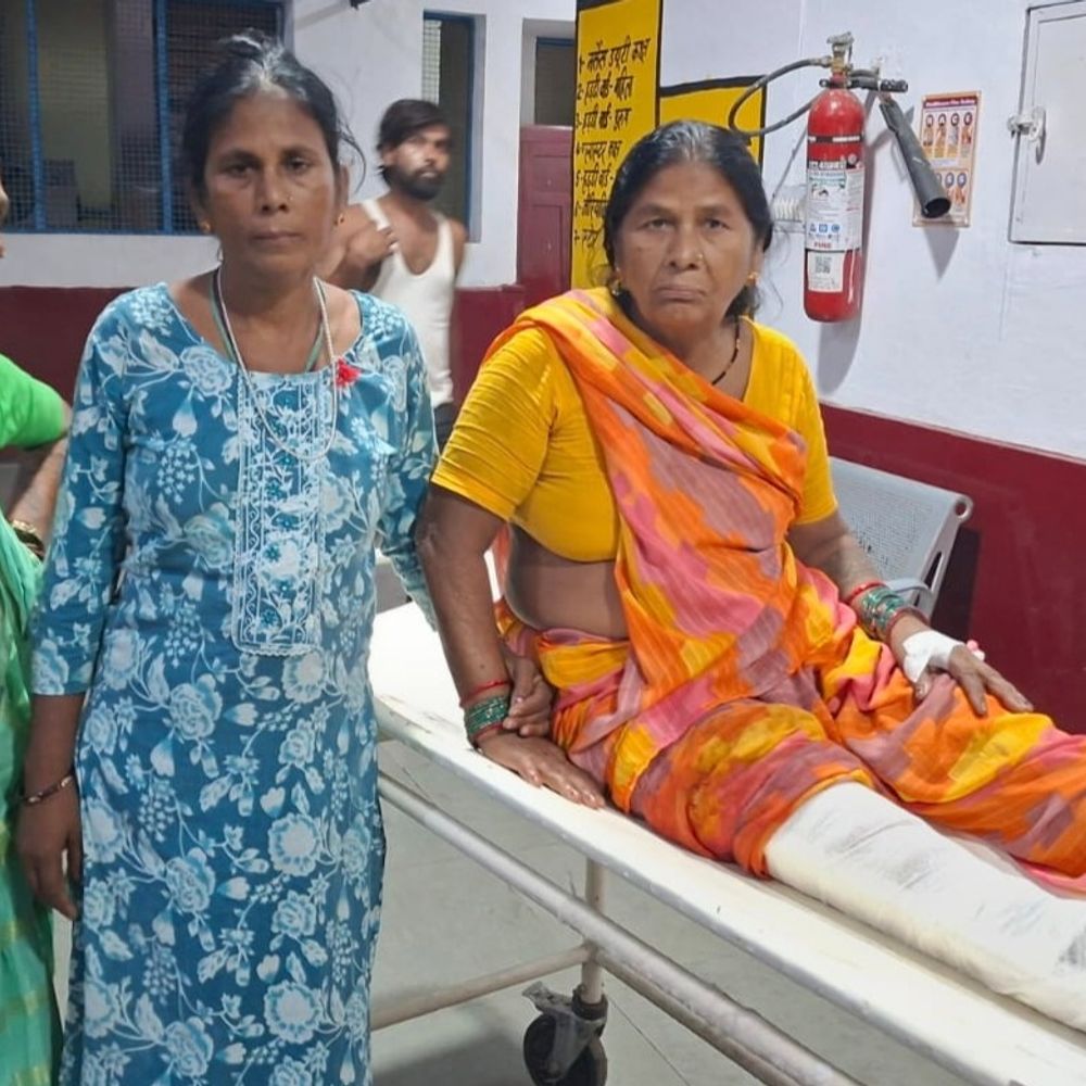 नेपाली तीर्थ यात्रियों की बस रोडवेज से टकराई,35 घायल:देर रात मुरादाबाद में हुआ हादसा, हरिद्वार से लौट रहे थे नेपाली तीर्थ यात्री