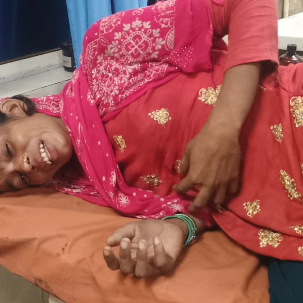 घोरमारा गांव में महिला से मारपीट:ससुराल पक्ष के लोगों पर लाठी-डंडों से मारपी का आरोप, सदर अस्पताल में भर्ती