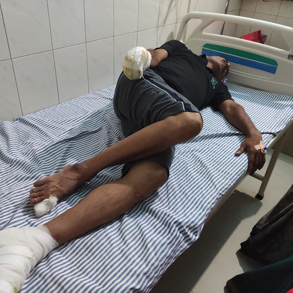 टीन शेड लगाते समय हाईटेंशन तार की चपेट में आए:जौनपुर में पिता-पुत्र समेत 3 झुलसे, गंभीर हालत में ट्रॉमा सेंटर रेफर