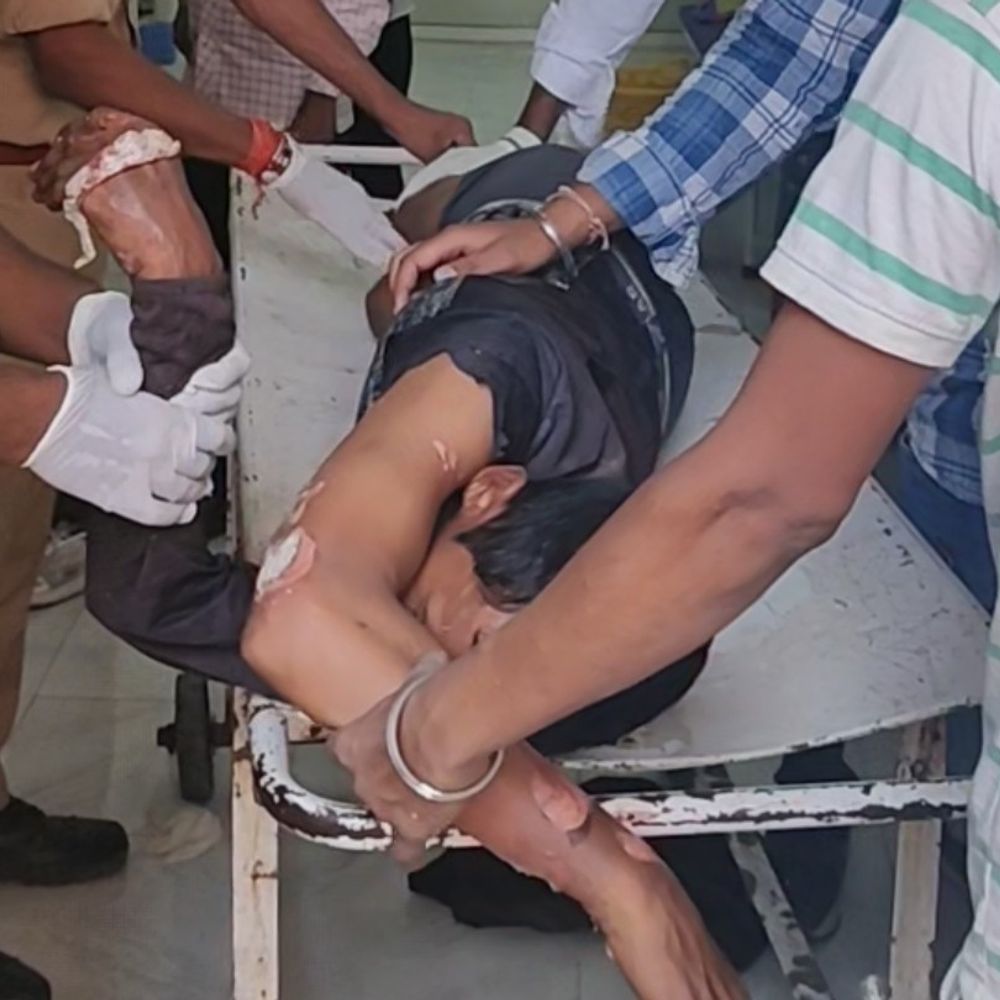 हाईटेंशन लाइन की चपेट में आकर मजदूर की मौत:हाथरस में कबाड़ उतारते समय हादसा, एक गंभीर रूप से झुलसा