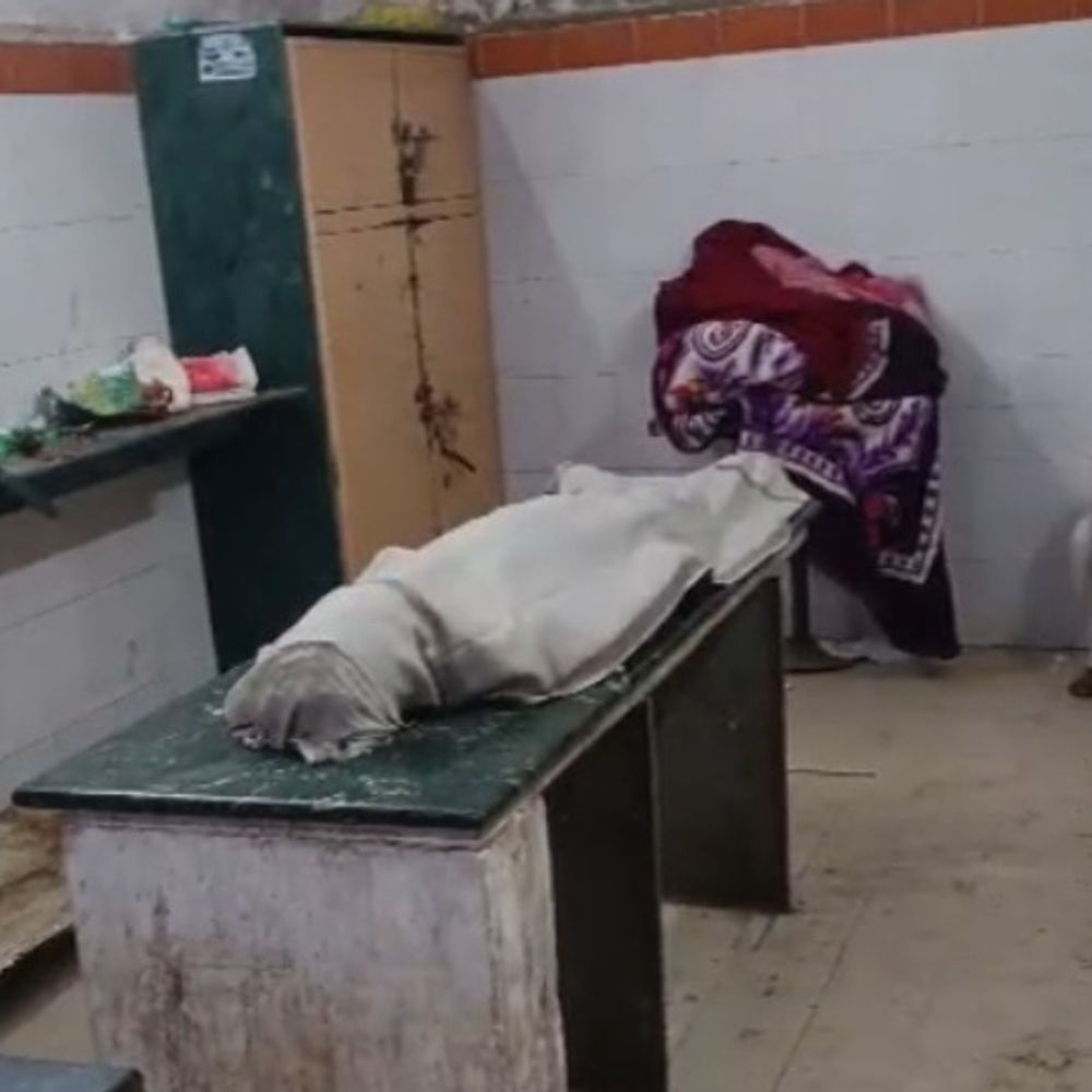 धार के सरदारपुर अस्पताल में पुराने ड्रेसिंग रूम में पोस्टमार्टम:बारिश में टपकती रही छत, शव के पास घूमते रहे कीड़े