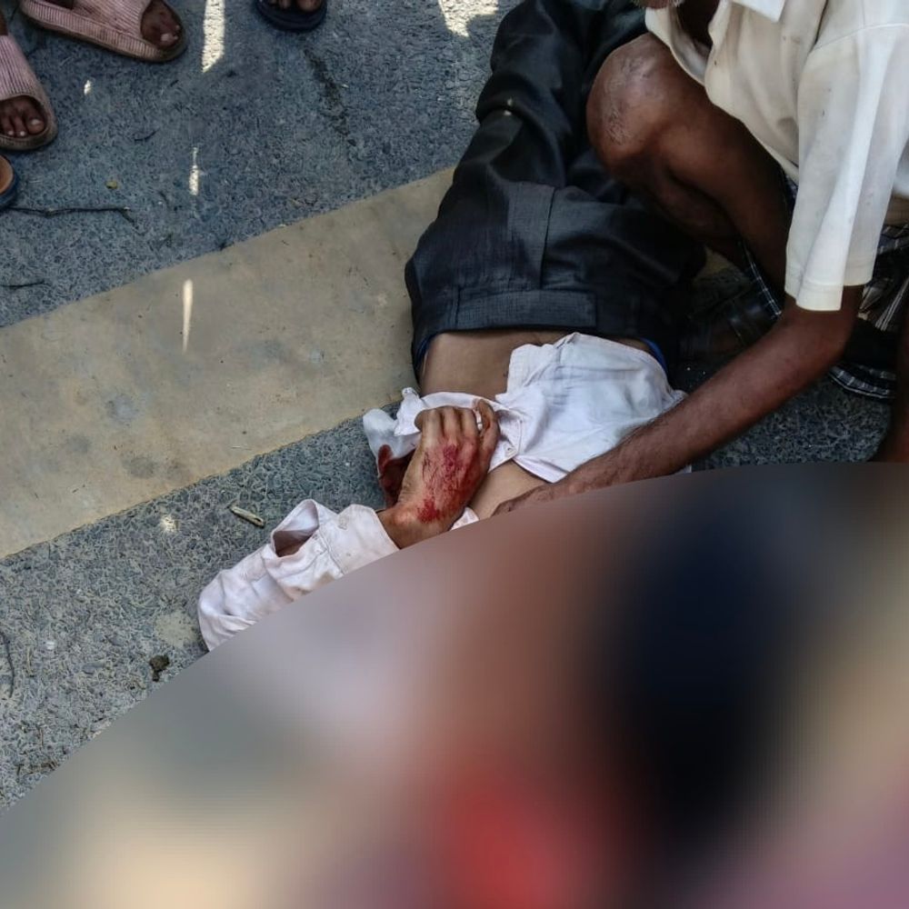 लखीमपुर में डीसीएम ने पैदल जा रहे युवक को रौंदा:सीएचसी में डॉक्टरों ने मृत घोषित किया, पोस्टमॉर्टम के लिए भेजा शव
