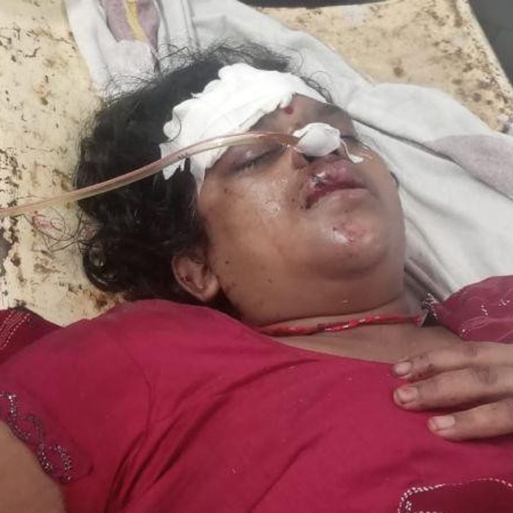 रीवा के संजय गांधी अस्पताल में मरीज की हालत बिगड़ी:परिजन बोले- डॉक्टरों की लापरवाही से शरीर में कीड़े पड़े, प्रबंधन ने आरोपों को बताया निराधार
