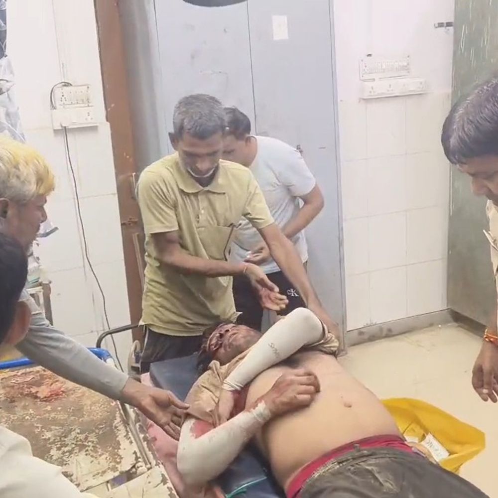बाइक सवार युवक पर धारदार हथियारों से हमला:बोलेरो सवार बदमाशों ने नाक, कान और सिर पर वार किया; गंभीर हालत में रेफर