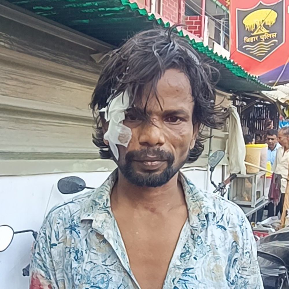 सामान डिलीवरी करने आए ऑटो चालक के साथ मारपीट:आंख के पास गंभीर चोट, चार-पांच युवकों पर 1000 रुपए मांगने का आरोप