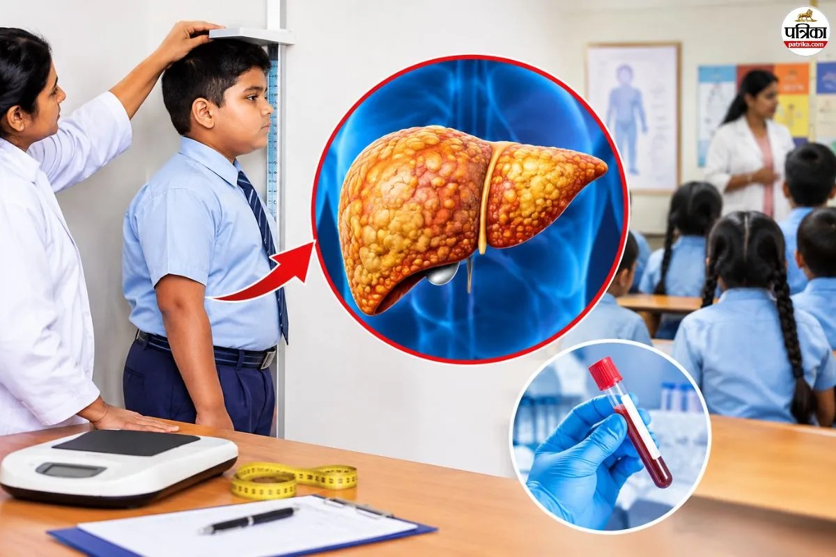 राजस्थान के सभी स्कूलों में बनेंगे ‘वॉच जोन’, ‘फैटी लिवर’ की स्क्रीनिंग के बाद सरकार का बड़ा फैसला