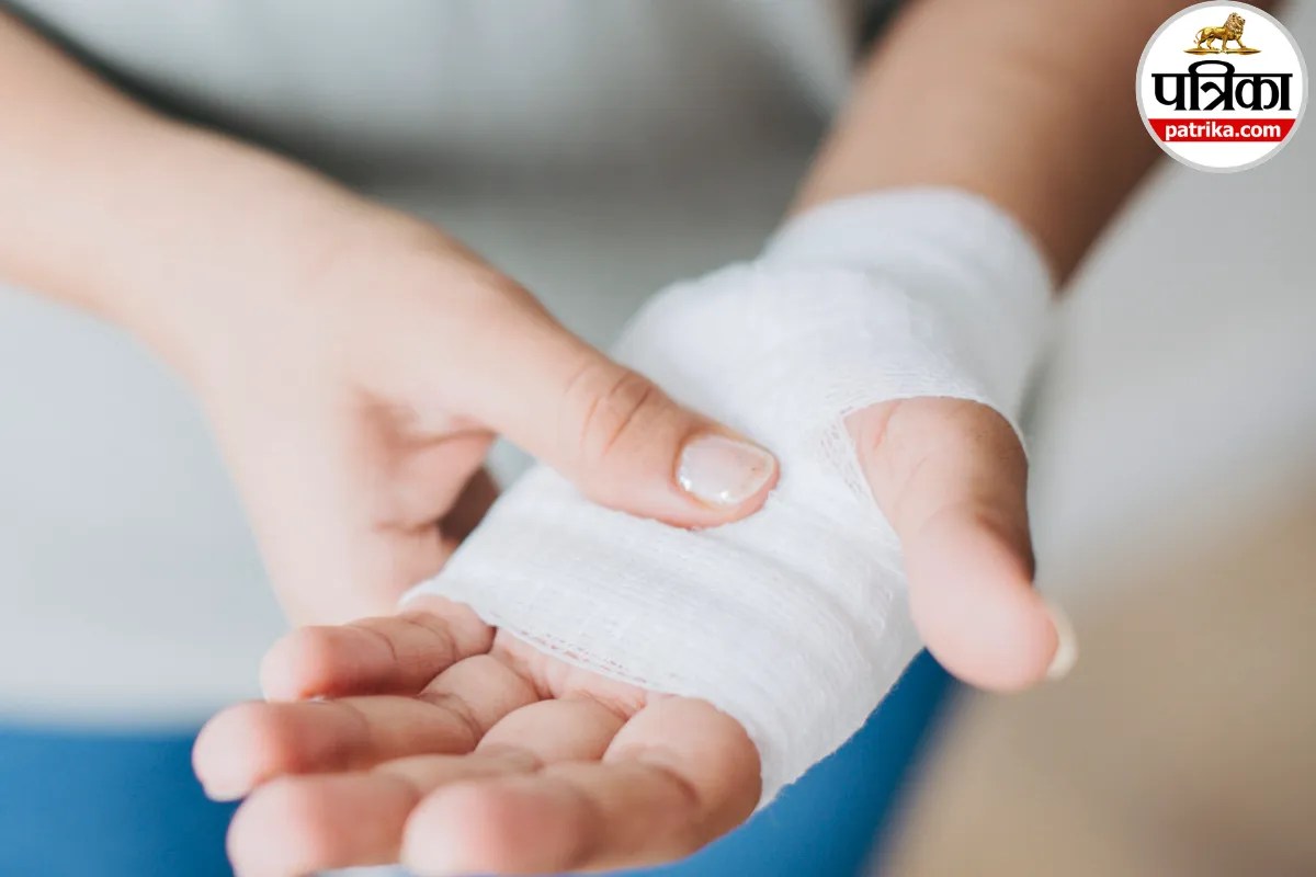Lacerations: चाकू, कांच या गिरने से लगा कट हो सकता है गंभीर, क्लीवलैंड क्लिनिक से जानें कब जाना चाहिए डॉक्टर?
