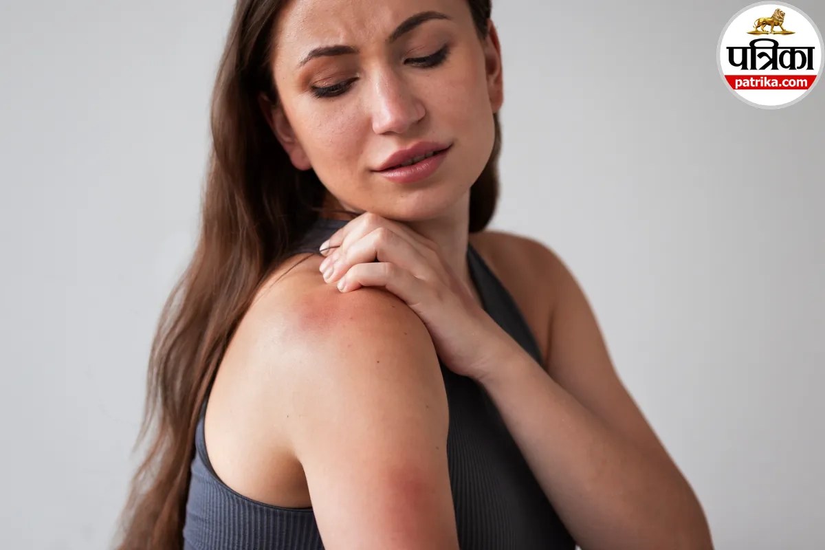 Radiation Burns: कैंसर के इलाज के दौरान त्वचा पर लालपन और पपड़ी क्यों जमती है? क्लीवलैंड क्लिनिक से समझें रेडिएशन बर्न की वजह