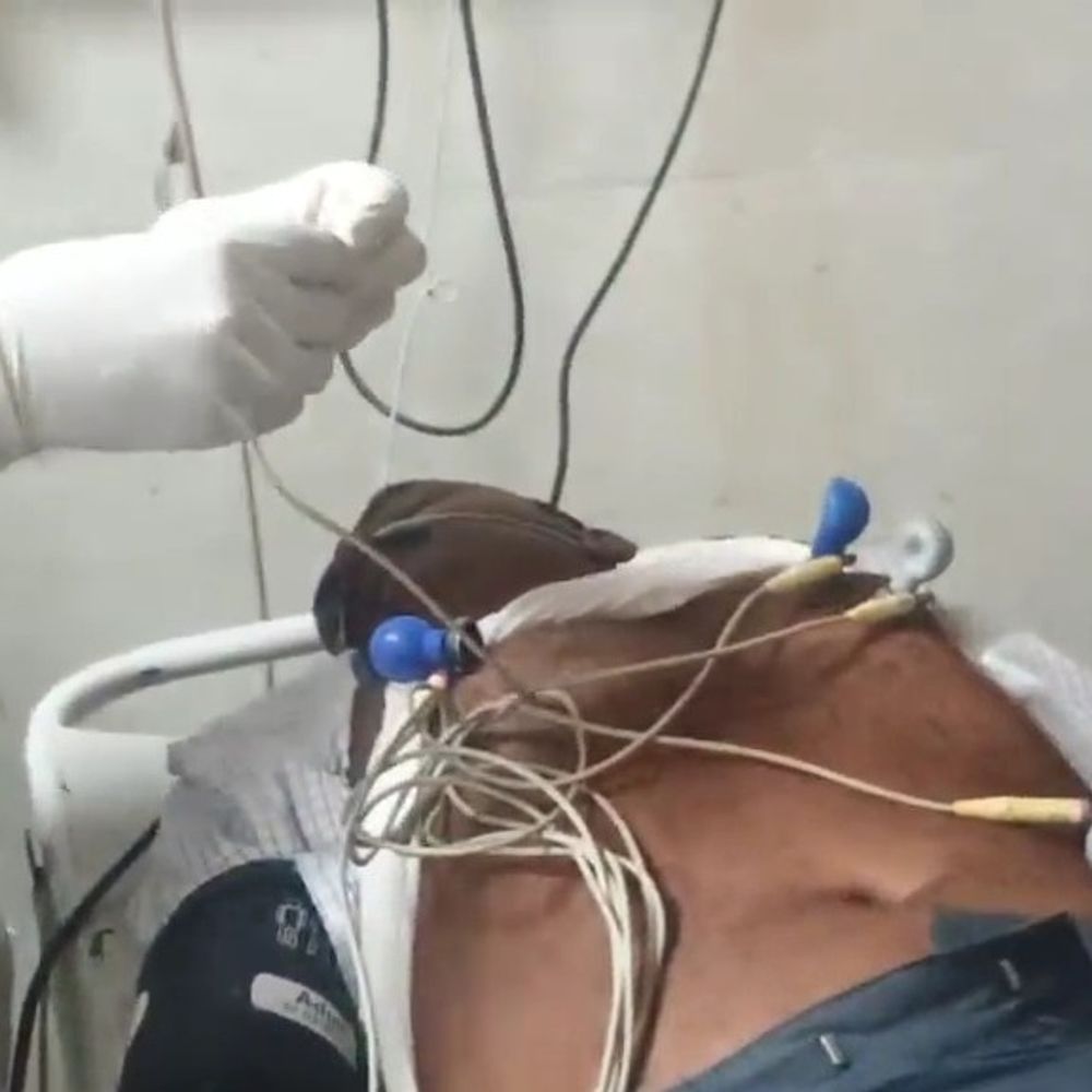 ट्रेन में यात्री के सीने में उठा तेज दर्द:अररिया में रेलवे ने स्टेशन पर उतारा, अस्पताल पहुंचते ही मौत, जोगबनी से कटिहार जा रहा था