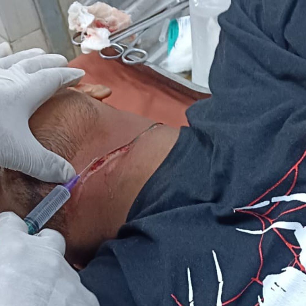 जौनपुर में चाइनीज मांझे से बाइक सवार की गर्दन कटी:दोस्तों ने कपड़ा रखकर रोका खून; समय पर इलाज मिलने से बची जान