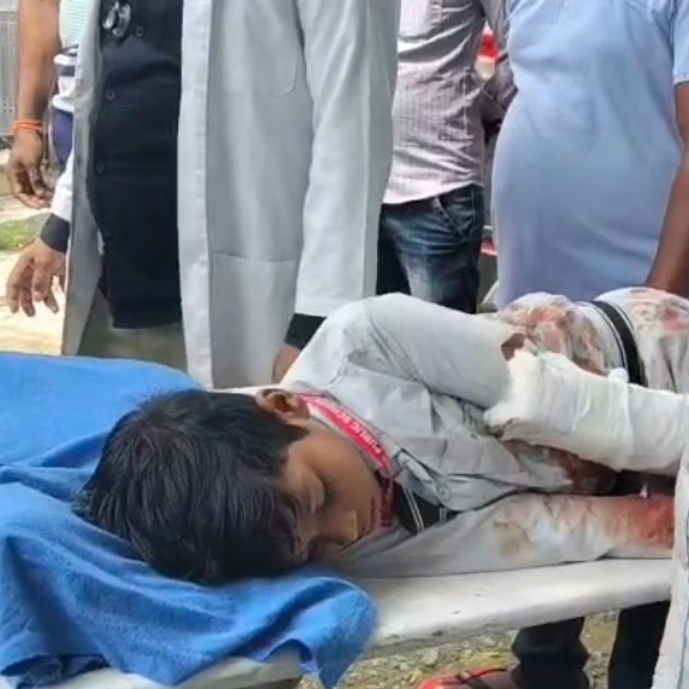 कौशांबी में बच्चों से भरा विक्रम पलटा, 4 घायल:दो की हालत गंभीर, आसपास के लोगों ने निकालकर अस्पताल पहुंचाया
