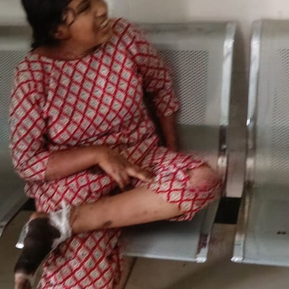 लखीमपुर के बिजुआ-भीरा रोड पर 2 बाइकों की टक्कर:शिक्षामित्र समेत 4 लोग गंभीर घायल, सीएचसी से जिला अस्पताल भेजे गए