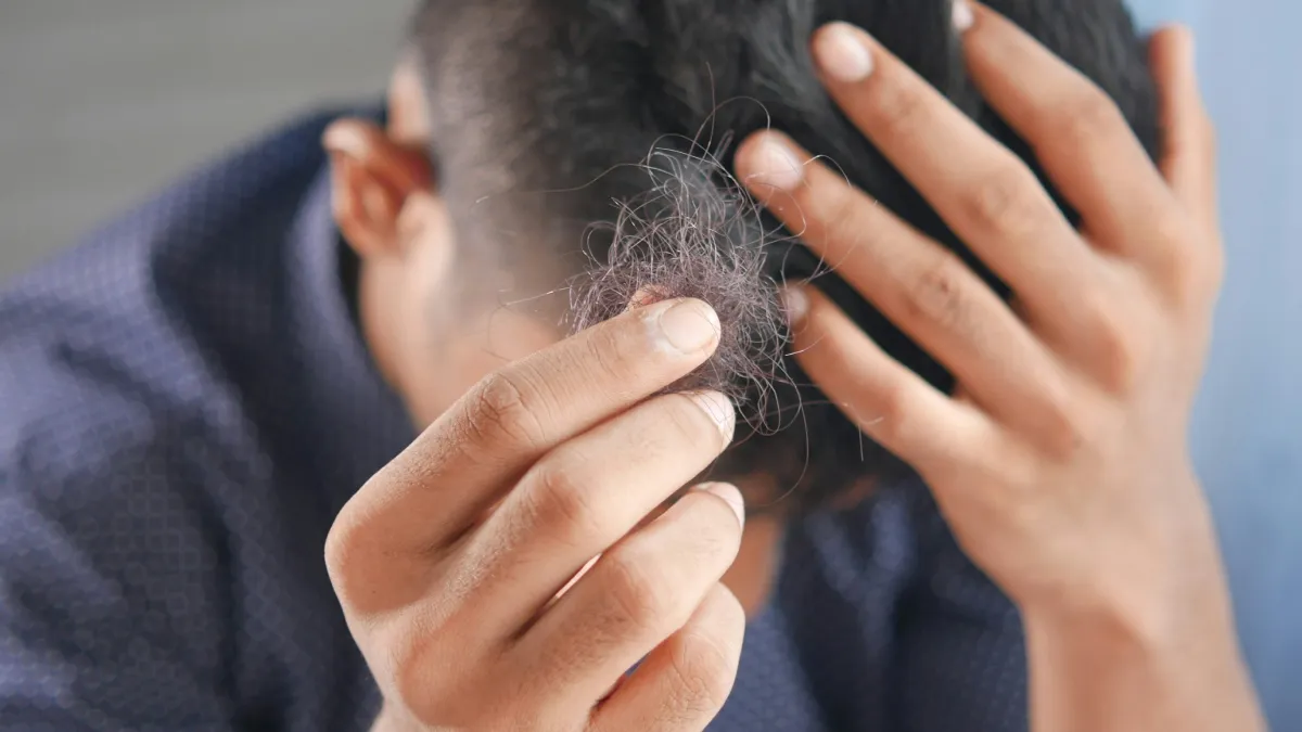 हेयर फॉल की समस्या बढ़ गयी है तो तुरंत छोड़ दें ये 5 Haircare Mistakes, डर्मेटोलॉजिस्ट ने किया अलर्ट