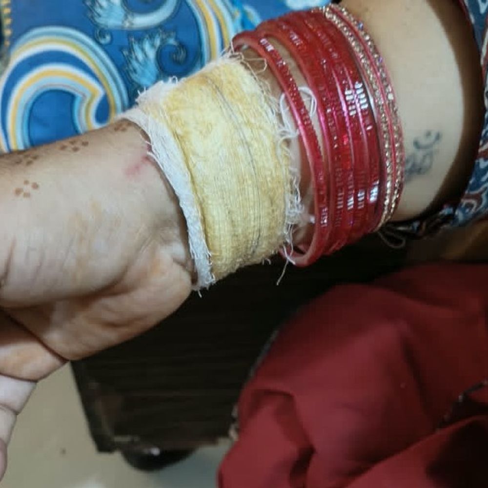 सतना में प्राचार्य-प्रोफेसर ने एक-दूसरे पर मारपीट का आरोप लगाया:क्लासरूम में टूटी चूड़ियां मिलीं, दोनों पक्षों ने थाने में दर्ज कराई एनसीआर