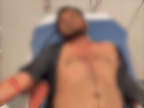 बोकारो हॉस्टल में चोरी करने आए 3 युवक:संचालक समेत तीन पर चाकू से किया हमला, CCTV के तार भी काटे, 1 आरोपी पकड़ाया